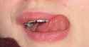 mouth1.jpg