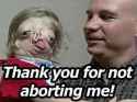 Abortions.jpg