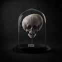 medicine 1388971445_Hydrocephalus-Skull.jpg