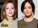 before-and-after.jpg