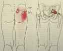 butthurt.jpg
