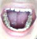 my mouth.jpg