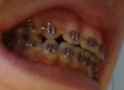 teetharino.png