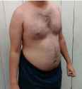 ethan fupa.jpg