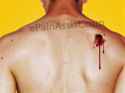 gunshot-wound-shoulders.jpg