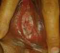 vaginal-image.jpg