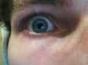 eye.jpg