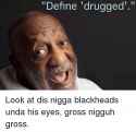 define-drugged-define-look-at-dis-nigga-blackheads-unda-his-1232012.png
