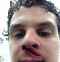 hit-by-a-puck-3.jpg