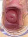 cervix_gape_-2323.jpg
