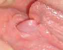 My-engorged-clitoris-)-1.jpg