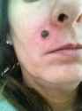 e365bea6e4c26d248e9c5be56eb9cf12--skin-tag-healthy-skin.jpg
