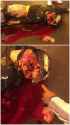 Show-me-where-it-hurts..-Imgur-169x300.jpg