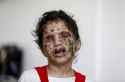 White_Phosphorous.jpg