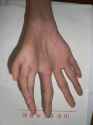 c6a966c897a0a7c95cafefd12c2bf486--medical-curiosities-human-oddities.jpg