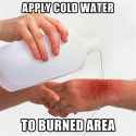 3075386-burn.jpg