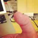 the status of his thumb.jpg