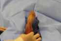 ntraoperative-image-after-intracorporeal-injection-with-papaverine-60-mg-Exam-reveals-a.jpg