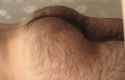Hairy-buttocks-e1521275147962.jpg