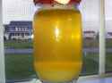 Urine-Sediment-11.jpg