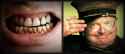 teeth and hill.jpg
