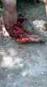 biker-act-distraught-destroy-lower-leg.jpg