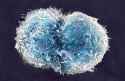 4-stem-cells-sem-.jpg