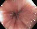 Healthy Anus.jpg
