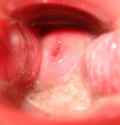 cervie-post-coitus-988x1024.jpg