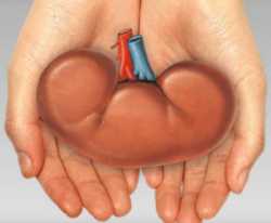 kidney_transplant.jpg