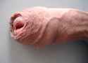 00_Uncut_Penis.jpg